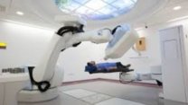 cyberknife treatment image