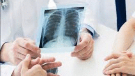 X-Ray OPG Services in Bengaluru